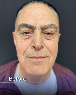 Slider image (8) Boroyan Plastic Surgery in Yerevan Armenia